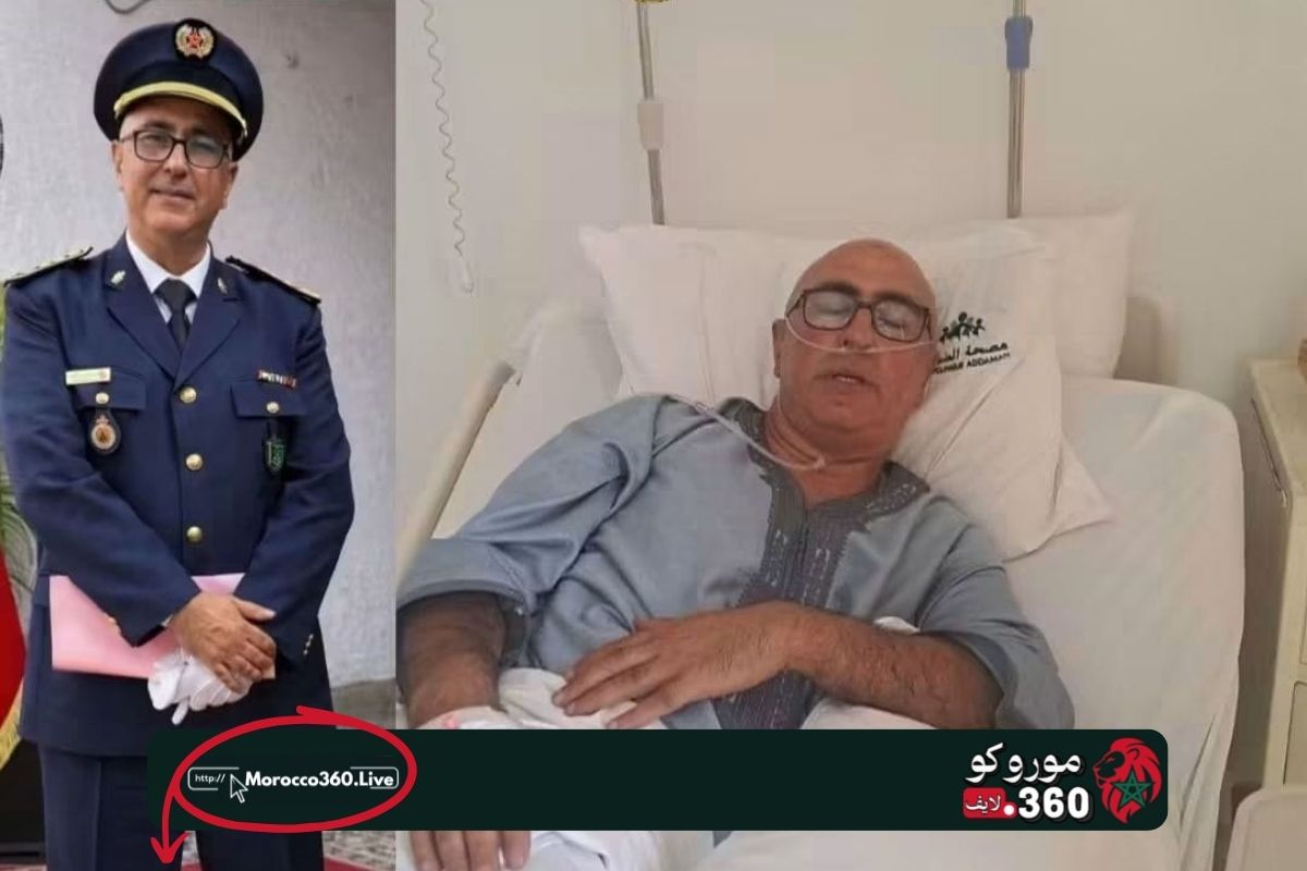 إصابة القائد الجهوي للوقاية المدنية بطنجة أثناء مواجهة حريق بالفحص أنجرة