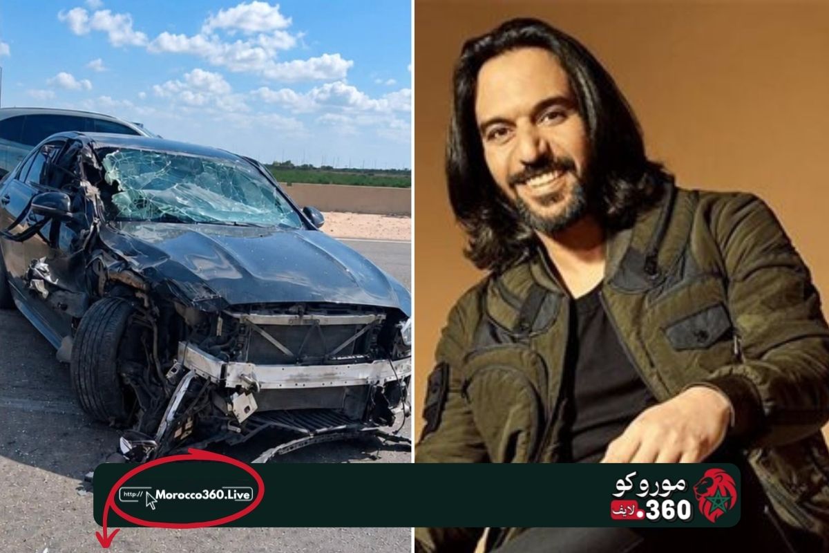 إصابات طفيفة لبهاء سلطان بعد انقلاب سيارته قرب العلمين.. والمستشفى يطمئن الجمهور
